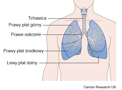 Grafika przedstawia części układu oddechowego tchawica, płaty płuc, oskrzela, nowotwór płuc 