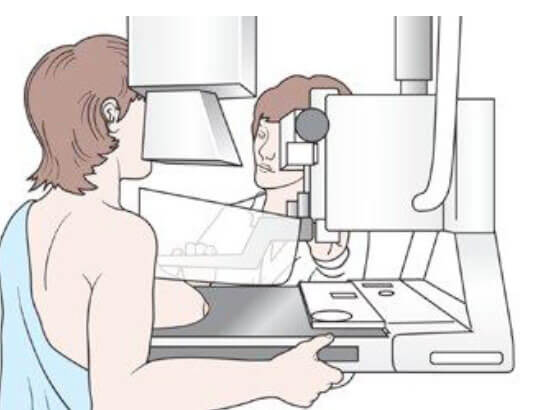 Nowotwór piersi Grafika pokazująca kobietę mającą badanie mammograficzne